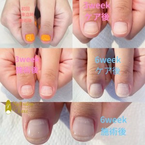 F465AA0B-
