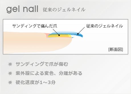 爪が痛む従来のジェルネイル